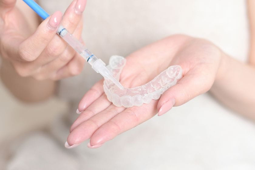 ホームホワイトニングの様子